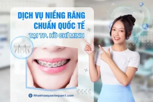 Dịch vụ niềng răng tại Quận 1 Hồ Chí Minh