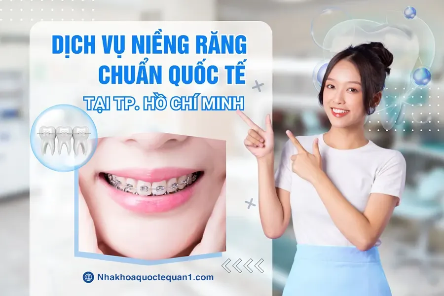 Dịch vụ niềng răng tại Quận 1 Hồ Chí Minh