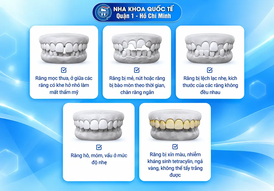 các trường hợp nên dán sứ
